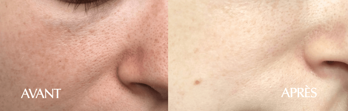 Purifying Mask 25ml