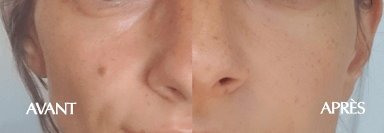 Lotion pour le visage illuminante 120ml