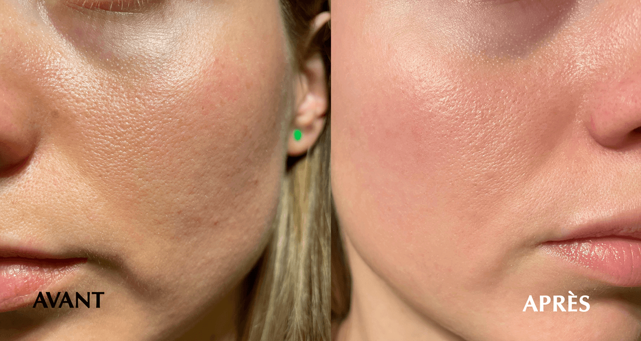 Masque Booster de Rajeunissement Arctique 25ml