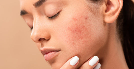 The Impact of Sugar on Your Skin