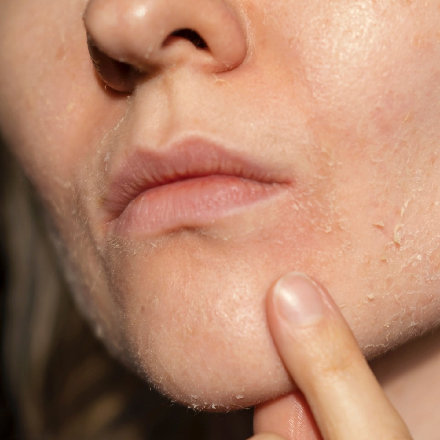 How to Hydrate Dehydrated Skin: Ingredients, Routine & Tips