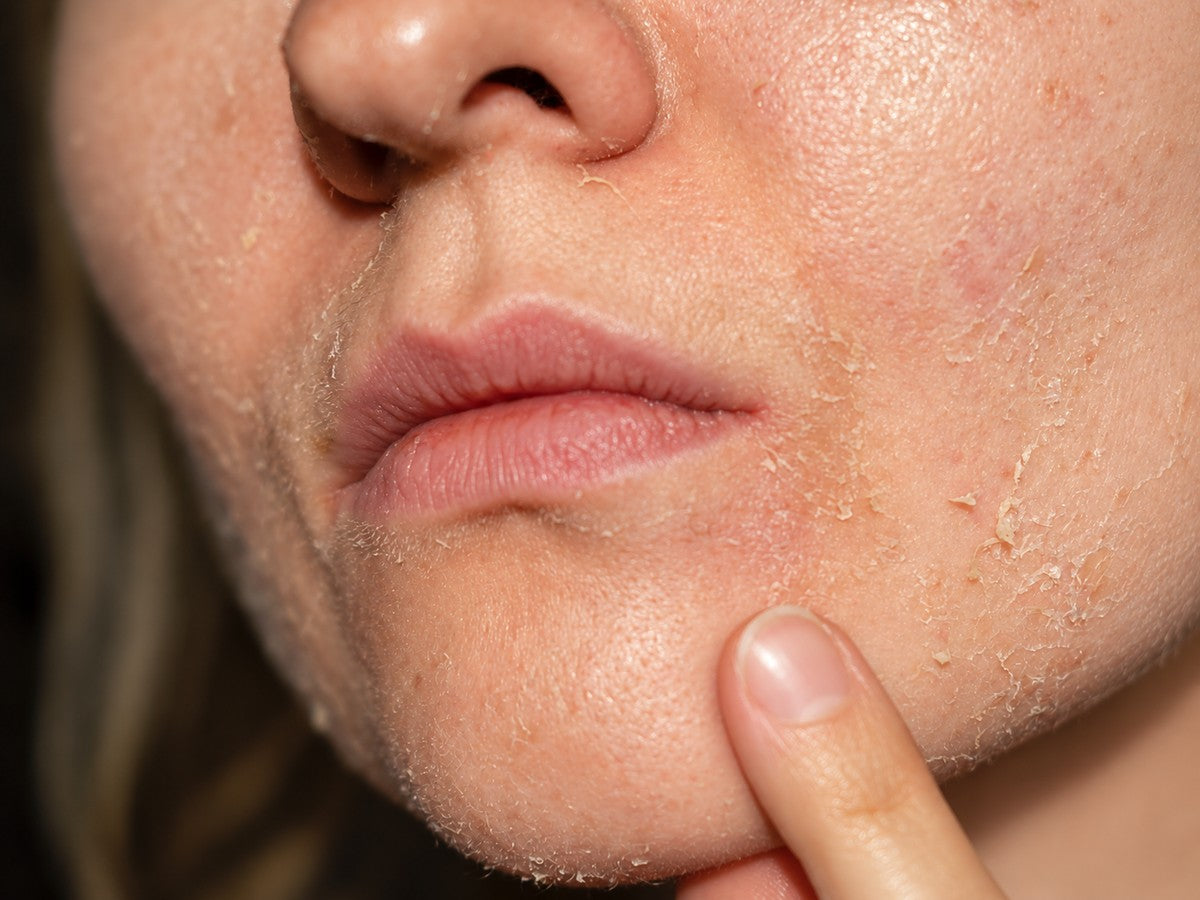 How to Hydrate Dehydrated Skin: Ingredients, Routine & Tips