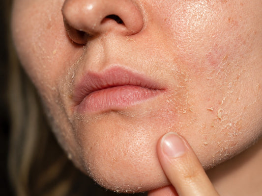 How to Hydrate Dehydrated Skin: Ingredients, Routine & Tips