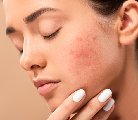 The Impact of Sugar on Your Skin: What You Need to Know...