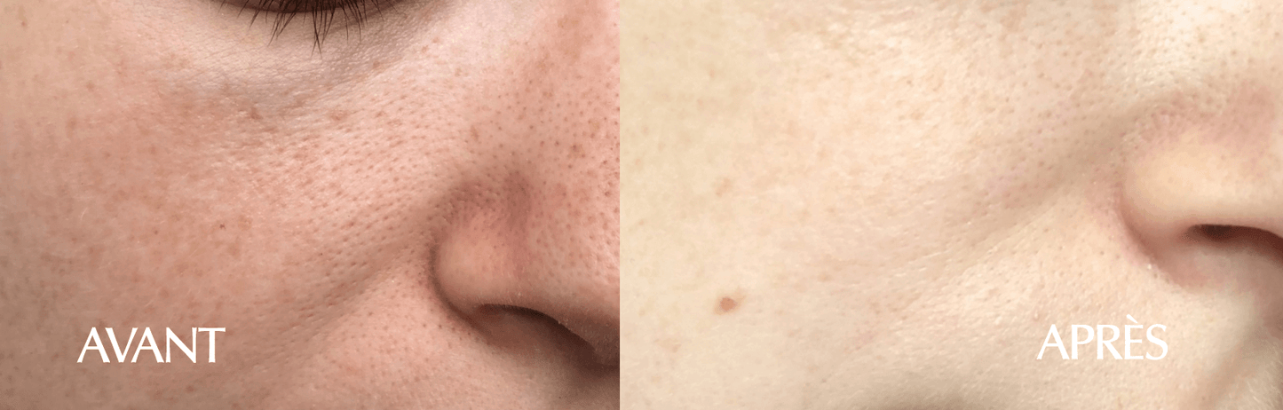 Masque Purifiant 25 ml x 1 pièce