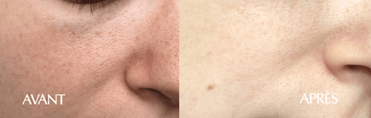 Masque Purifiant 25 ml x 1 pièce