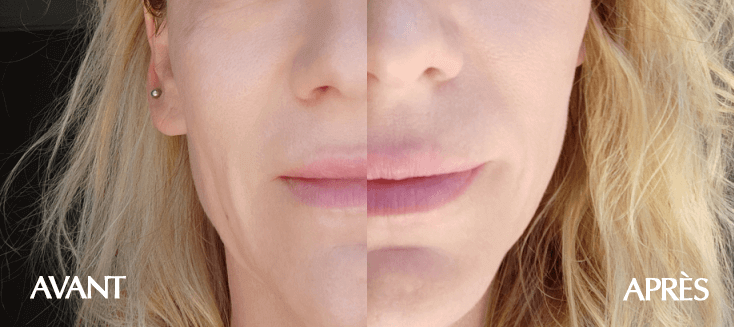 Masque anti-âge 25 ml x 10 pièces