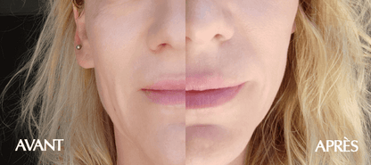 Masque anti-âge 25 ml x 10 pièces