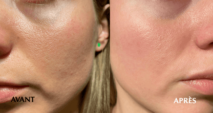Masque Booster Rajeunissement Arctique 25 ml x 5 pièces